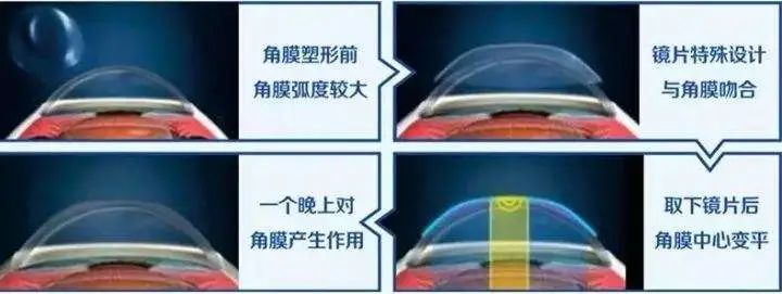 戴眼鏡會變丑 戴眼鏡會變丑