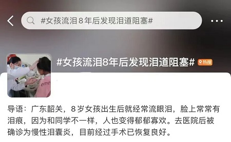 慢性淚囊炎,眼睛莫名流淚是怎么回事 慢性淚囊炎,眼睛莫名流淚是怎么回事