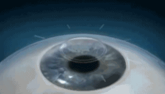 半飛秒2.gif