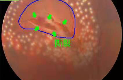 別小瞧這類影子，它很有可能對(duì)人們的眼鏡身心健康挺大傷害!