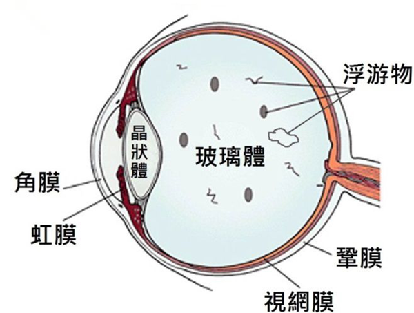 近視,遠(yuǎn)視,老花眼,散光眼,白內(nèi)障,飛蚊癥,?，斞劭漆t(yī)院