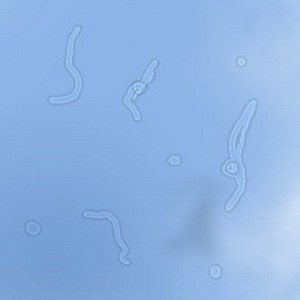 飛蚊,病癥,玻璃體,視網(wǎng)膜,珠海?，斞劭漆t(yī)院