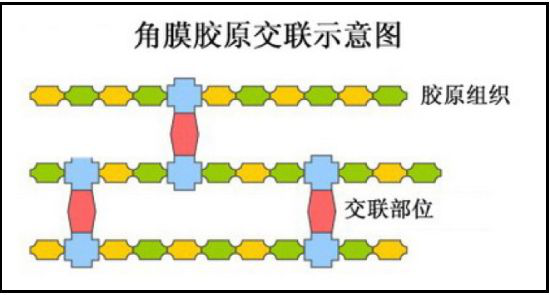 青少年近視,兒童近視,OK鏡,珠海?，斞劭漆t(yī)院