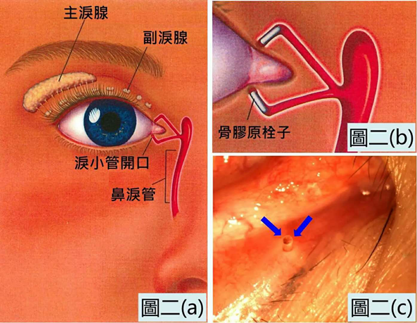 干眼癥,眼睛干澀,眼干癥,珠海?，斞劭漆t(yī)院