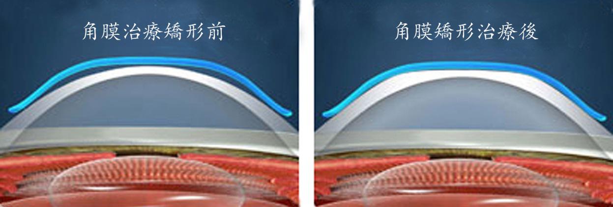 OK鏡,珠海OK鏡,珠海?，斞劭漆t(yī)院
