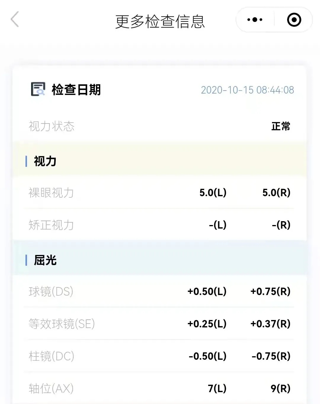 視力檢查怎么做,兒童視力篩查方法 視力檢查怎么做,兒童視力篩查方法