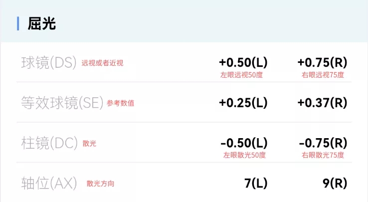 視力檢查怎么做,兒童視力篩查方法 視力檢查怎么做,兒童視力篩查方法
